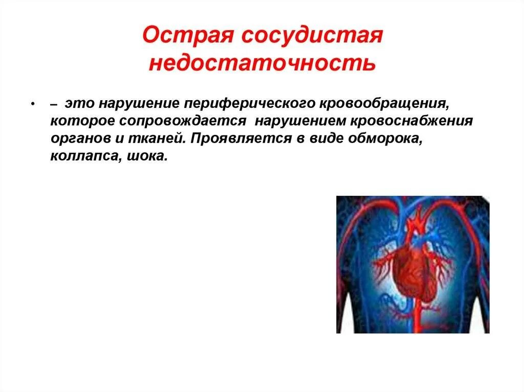 Синдром острой сосудистой недостаточности характеризуется. Синдром острой сосудистой недостаточности (обморок, коллапс, ШОК). Клинические проявления острой сердечно-сосудистой недостаточности. Острая сосуд недостаточность. Острое сердечное нарушение