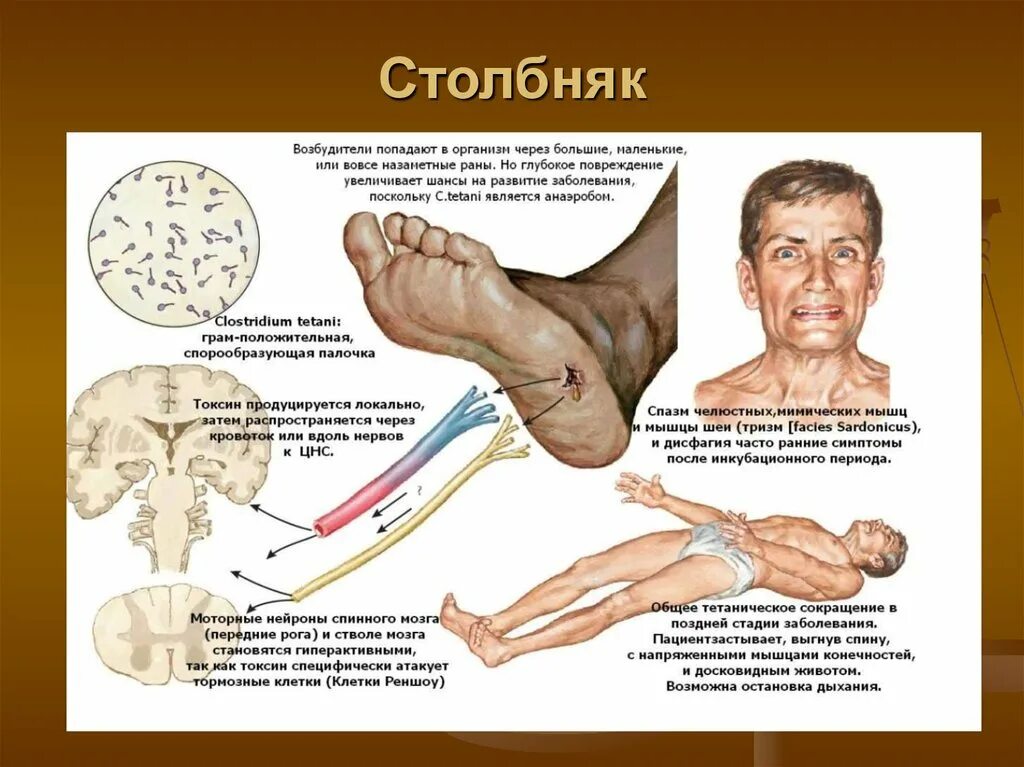 Сколько развивается столбняк