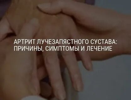Лечение артроза запястий
