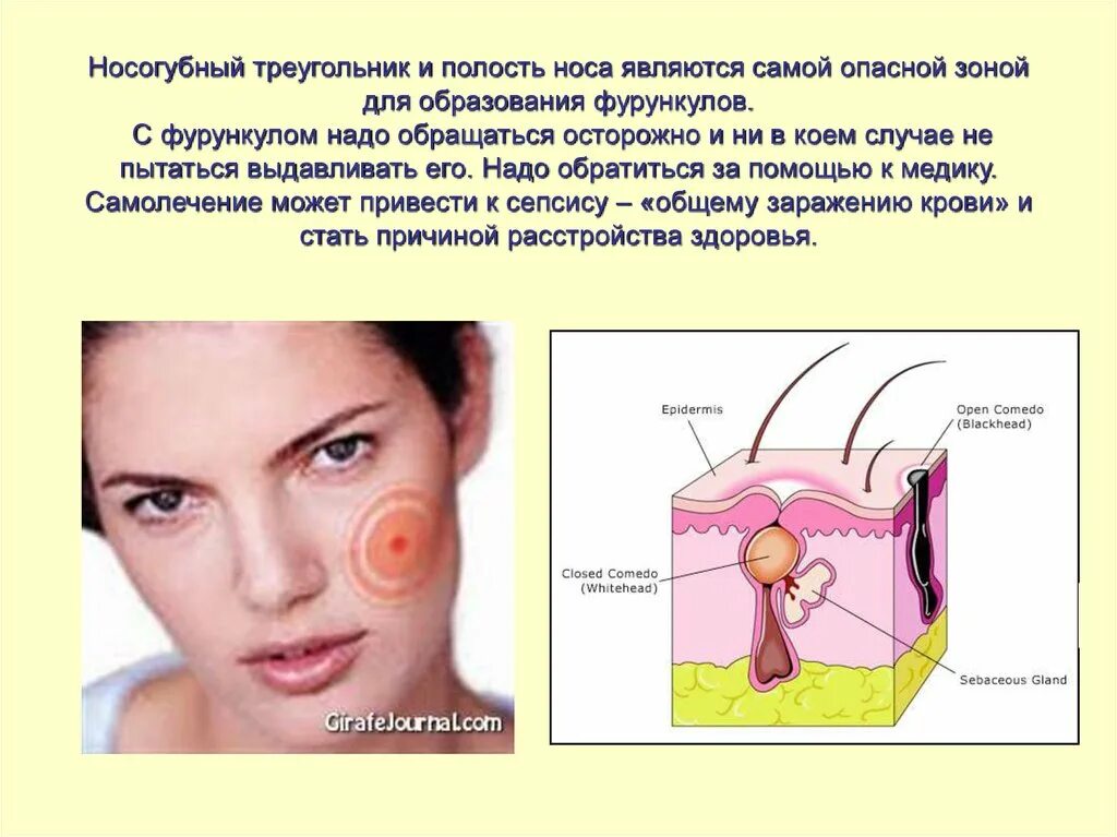 Почему нельзя давить на лице