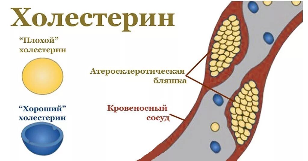 Холестерин. Плохой и хороший холестерин. Хороший холестерин. Плохой или хороший холестерин.