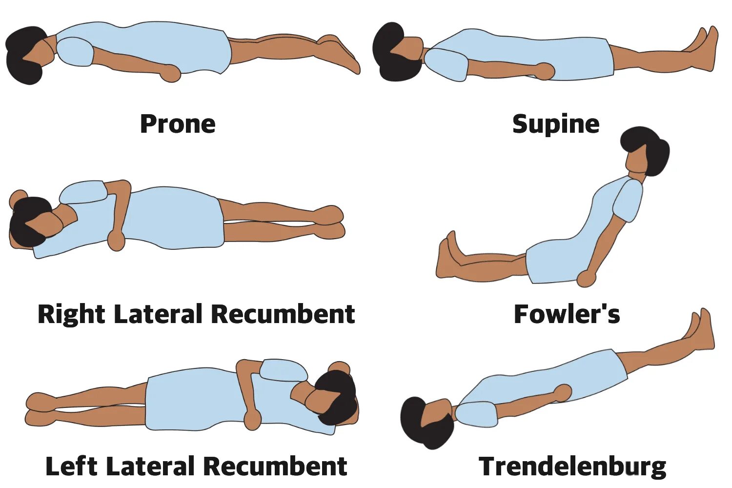 Prone позиция. Supin. Supine position. Lateral position.