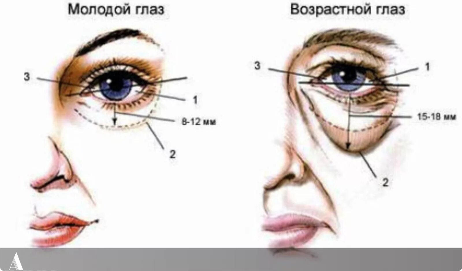 Мышцы под глазами