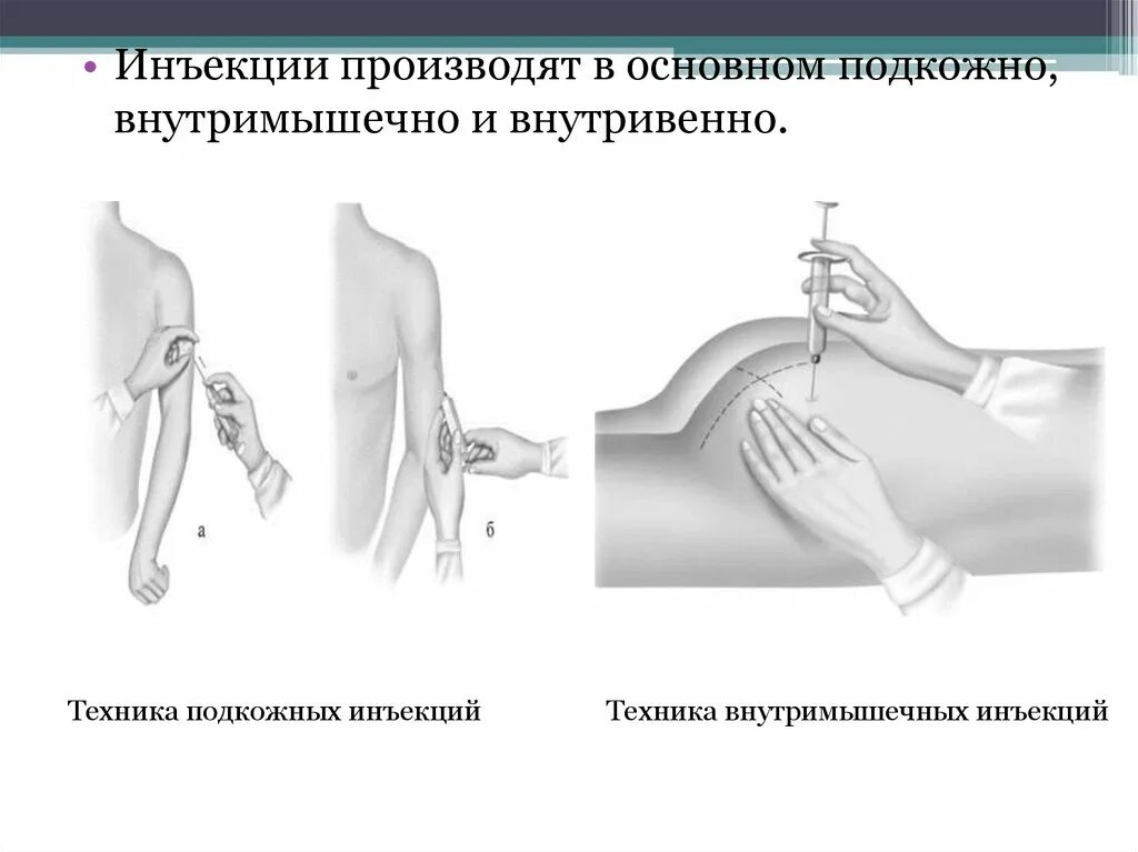 Внутримышечная инъекция алгоритм сестринское. Подкожно внутрикожно внутримышечно внутривенно. Глубина введения иглы при проведении подкожной инъекции. Парентеральное Введение внутримышечно инъекции. Угол выполнения для подкожной инъекции.