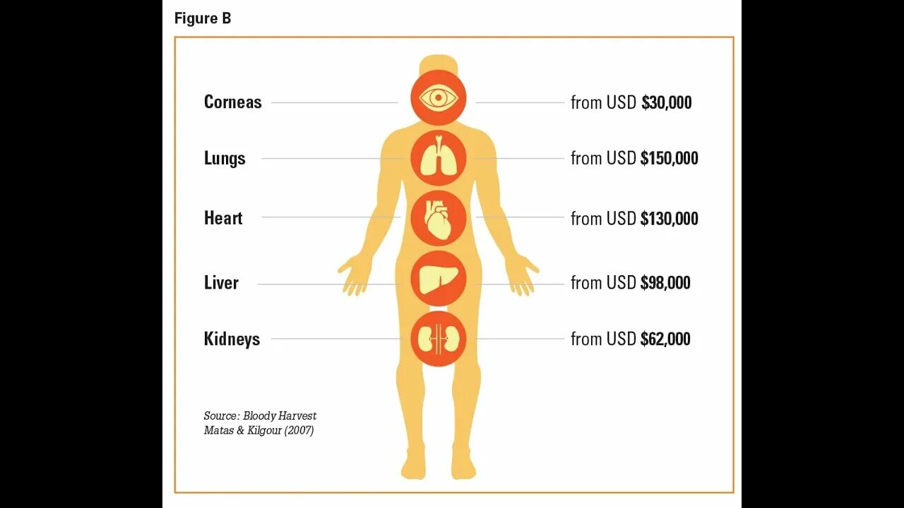 Самой дорогой орган человек. Сколько стоят органы. Продажа человеческих органов. Сколько стоят органы человека. Самый дорогой орган человека.