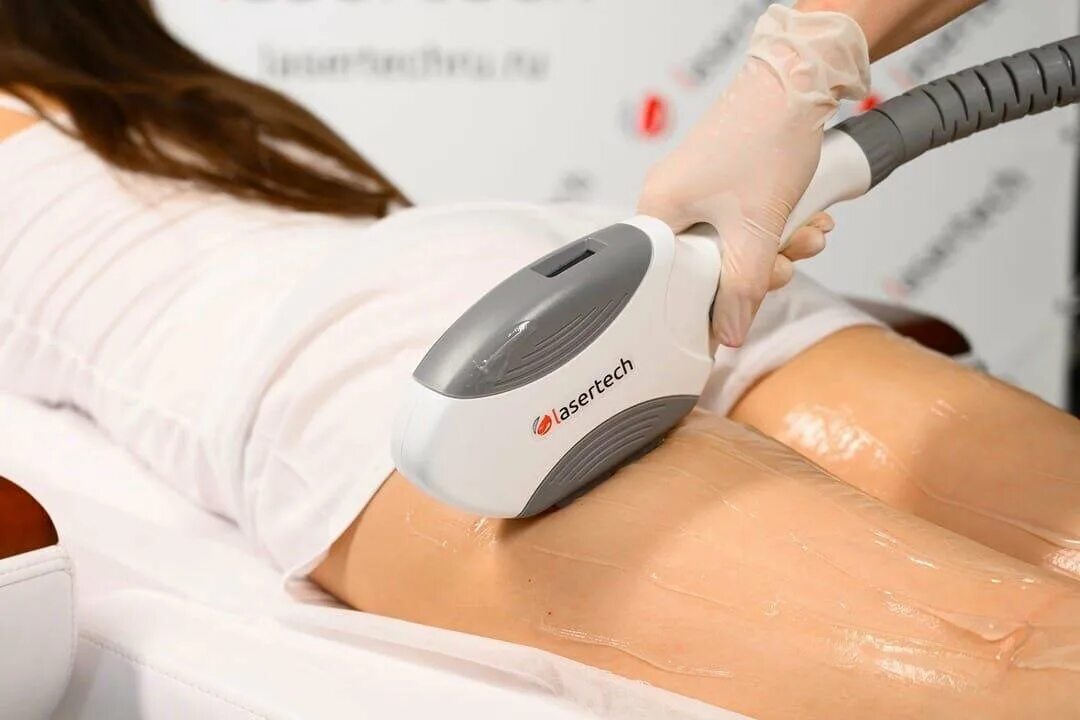 Лазерная эпиляция elos. Лазерная эпиляция элос. Фотоэпиляция элос. Аппарат лазерной эпиляции элос 360. Фотоэпиляция элос.