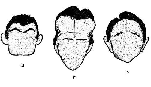 Физиогномика лоб. Форма черепа физиогномика. Узкий лоб физиогномика. Скошенный лоб физиогномика. Форма лба физиогномика.