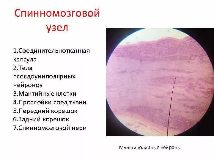 Спинномозговой чувствительный узел