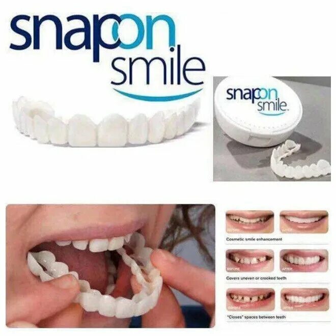 Виниры комплект Snap-on smile. Виниры для зубов snapon smile. Съемные виниры для зубов Snap-on smile. Виниры для зубов snapon smile 2 шт (белый).