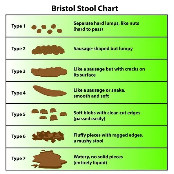 Type like. Bristol Stool Chart. What are causes of diarrhea?. What are the causes of watery Stools?.