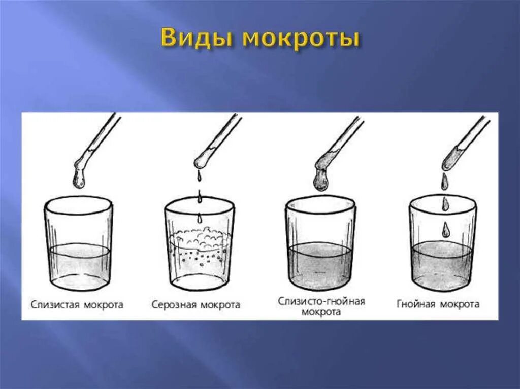 Лечение мокроты в домашних условиях. Виды моеротв.