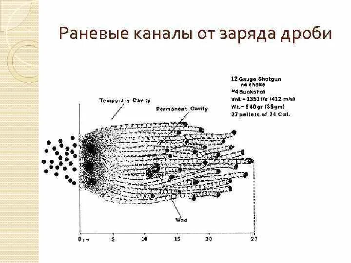 Зоны огнестрельного ранения
