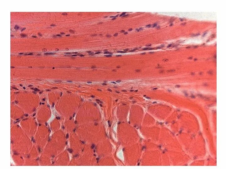 Скелетная мышечная ткань гистология препарат. Поперечнополосатая Скелетная мышечная гистология. Поперечнополосатая Скелетная мышечная ткань препарат. Поперечно полосатая Скелетная мышечная ткань гистология препарат. Препарат поперечно полосатая мышечная ткань