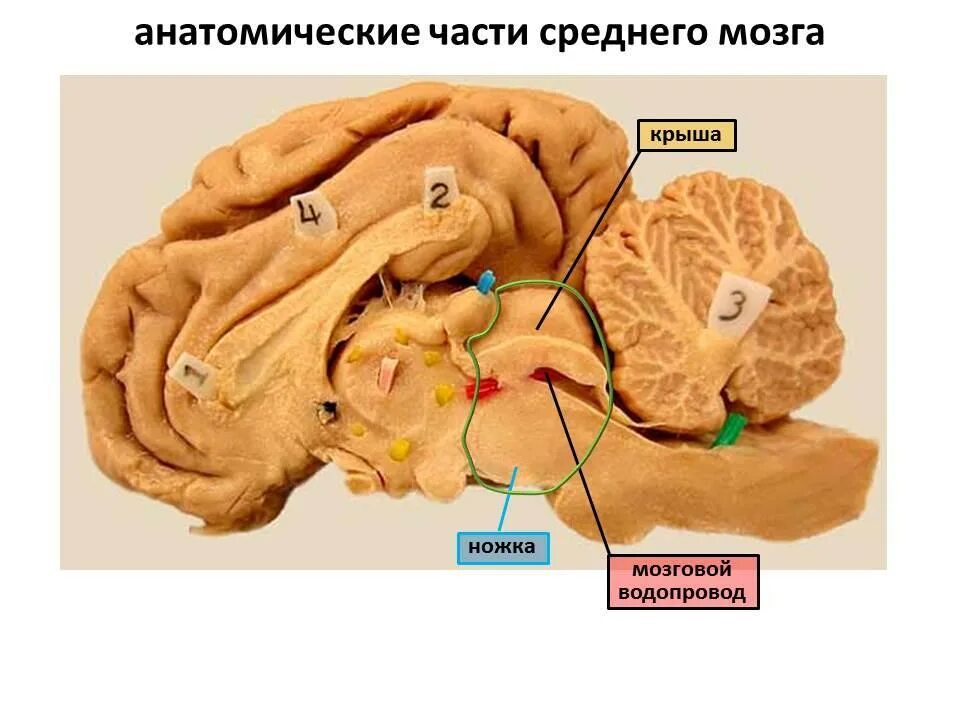 Крыша среднего мозга. Крыша среднего мозга (пластинка четверохолмия). средний мозг сильвиев водопровод. четверохолмие головного мозга анатомия. пластинка четверохолмия анатомия.