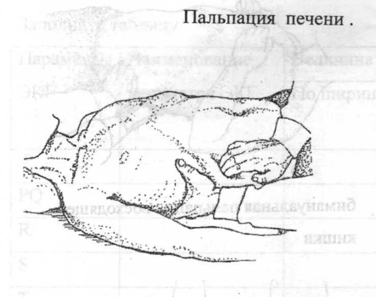 Край печени пальпируется. Пальпация печени алгоритм. Пальпация печени по Образцову-Стражеско. Пальпация Нижнего края печени. Продемонстрируйте технику пальпации Нижнего края печени..