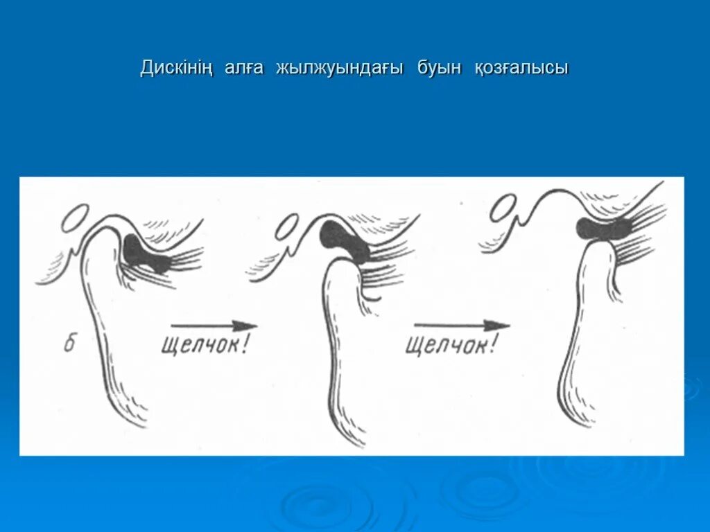 Причина щелканья