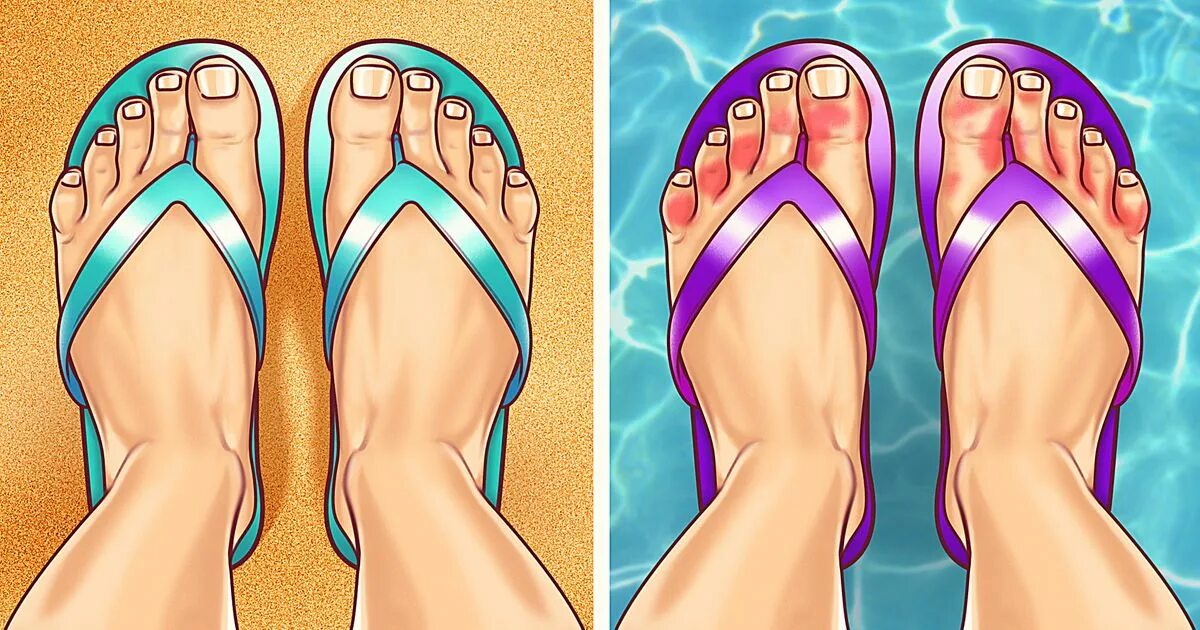 Pink foot. Feet cartoon. One foot cartoon. Fit vs feet cartoon.