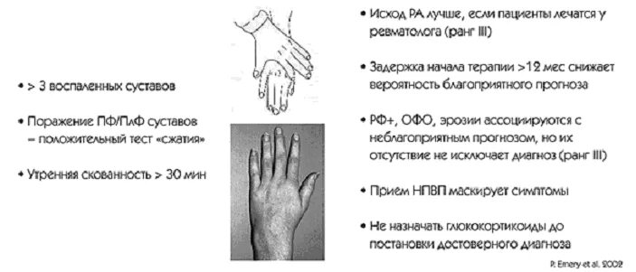 Ревматолог симптомы. Ранняя диагностика ревматоидного артрита. тест сжатия при ревматоидном артрите. диагноз ревматолога. ревматоидный артрит тест сжатия это.