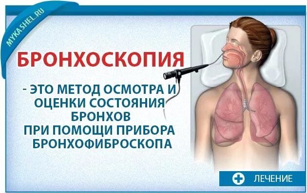 Бронхоскопия какой метод. Подготовка пациента к бронхоскопии. подготовка к бронхоскопии памятка для пациента. подготовка к бронхоскопии легких. бронхоскопия алгоритм.