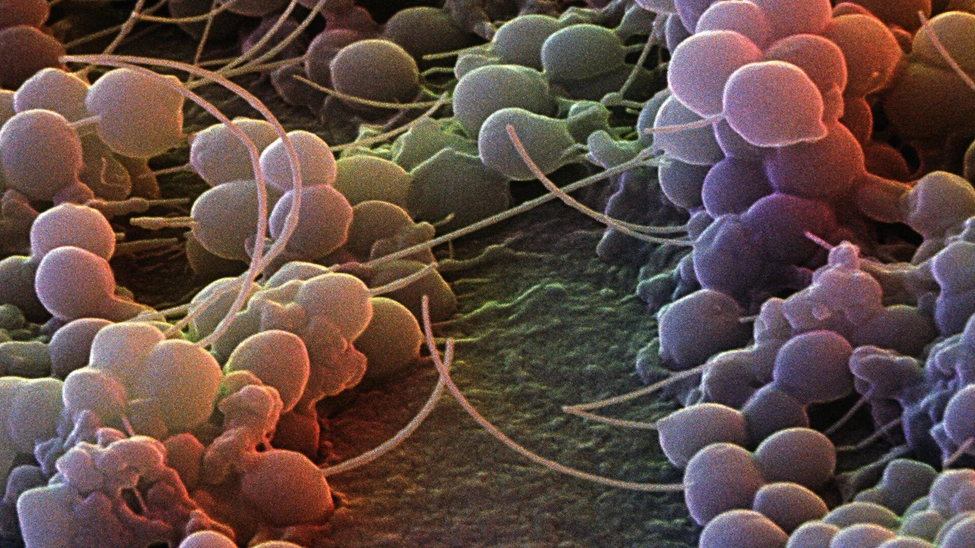 Болезнетворная бактерия 7. Эпидермальный стафилококк. Эпидермальный стафилококк Staphylococcus epidermidis. Эпидермальный стафилококк под микроскопом. Staphylococcus epidermidis под микроскопом.