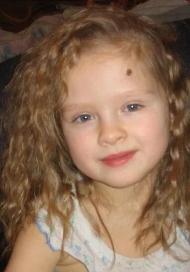 на щеке пятно родимое а на висках. милохин шрам. красные пятна на висках. на щеке пятно родимое а на висках. портрет левши.