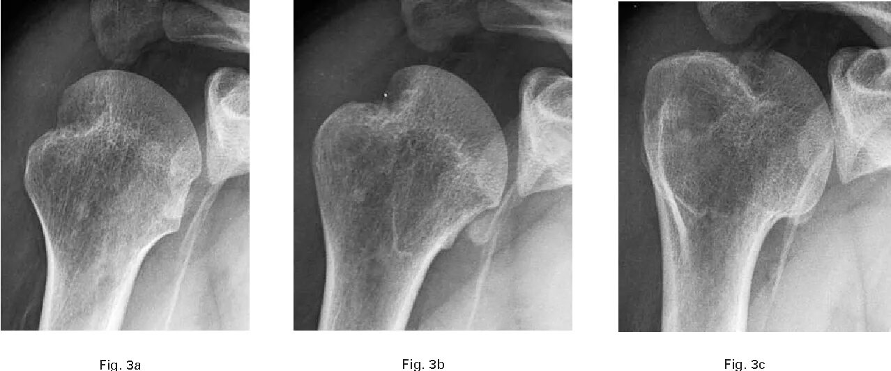 Pre operation