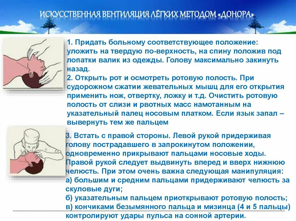 Искусственная вентиляция лёгких методом донора. Искусственная вентиляция лёгких алгоритм. Донорский способ искусственного дыхания.