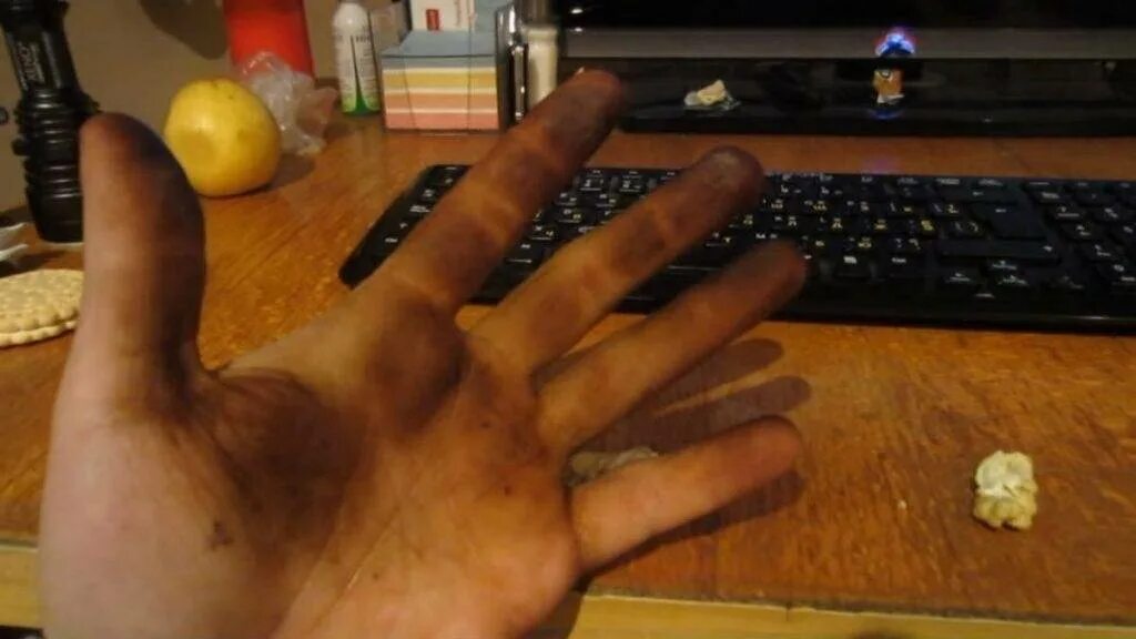 Старые морщинистые ступни. Солнечный дерматит и фотодерматит. Морщинистые ступни женщин. Гипергидроз рук на маникюре. Сморщенная кожа на пальцах.