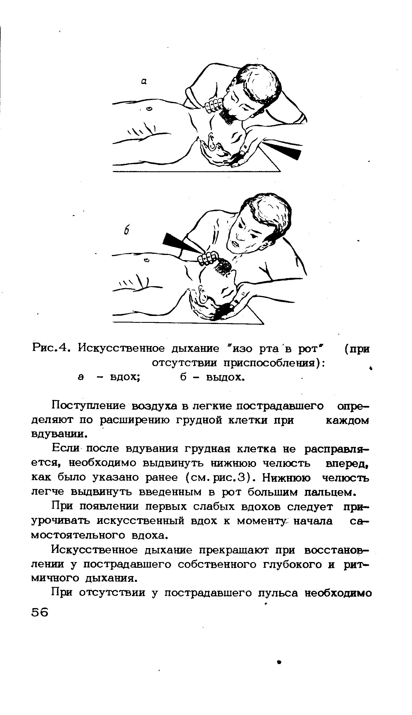 Искусственное дыхание картинки. Запрокинуть голову пострадавшего. Правила оказания искусственного дыхания и непрямого массажа. Сон делал искусственное дыхание. Массаж сердца и искусственное дыхание.