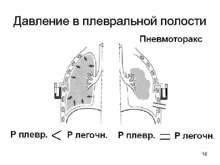 Правая плевральная полость. Строение плевральной полости. Где находится плевральная полость. Расположен в плевральной полости. Синусы плевральной полости.