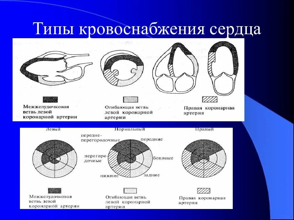 Тип кровотока 1 типа. Правый тип кровоснабжения миокарда левого желудочка. тип коронарного кровотока. схема кровоснабжения миокарда. левый тип кровоснабжения миокарда.