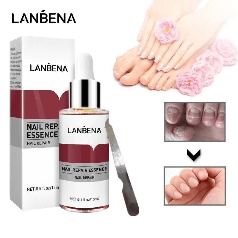 Средство от грибка ногтей LANBENA Nail Repair Essence 15 ml. Сыворотка для ногтей Ланбена. LANBENA эссенция для ногтей.