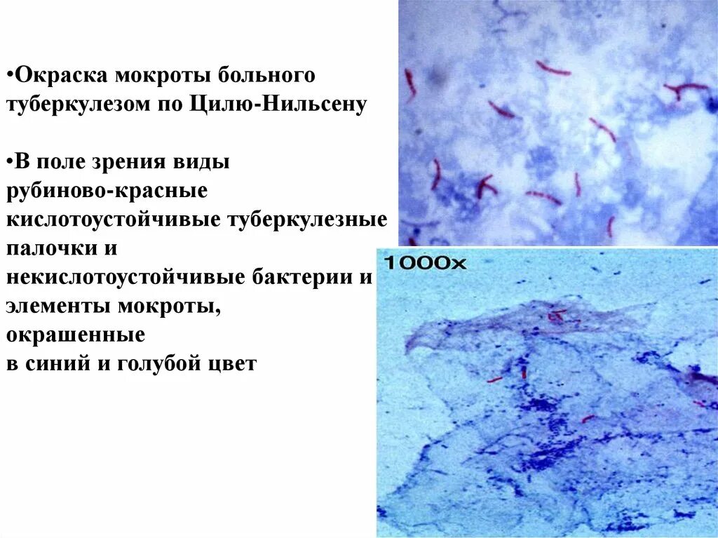 Мокрота окраска