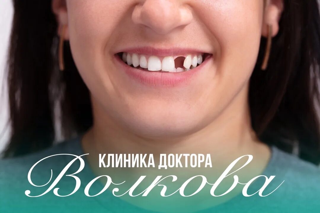 Верхние пятые зубы