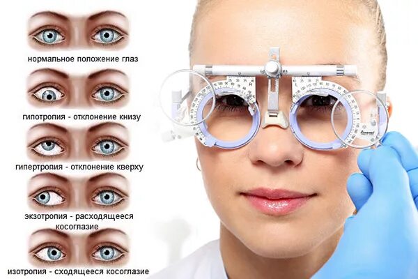 Форум зрение мочь. Косоглазие. люди с косоглазием. косоглазие у взрослых. зрение человек с косоглазием.