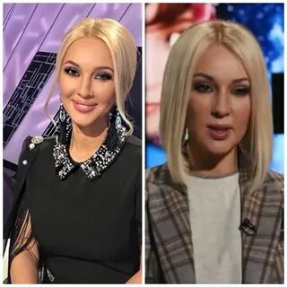 Фото кудрявцевой до пластики
