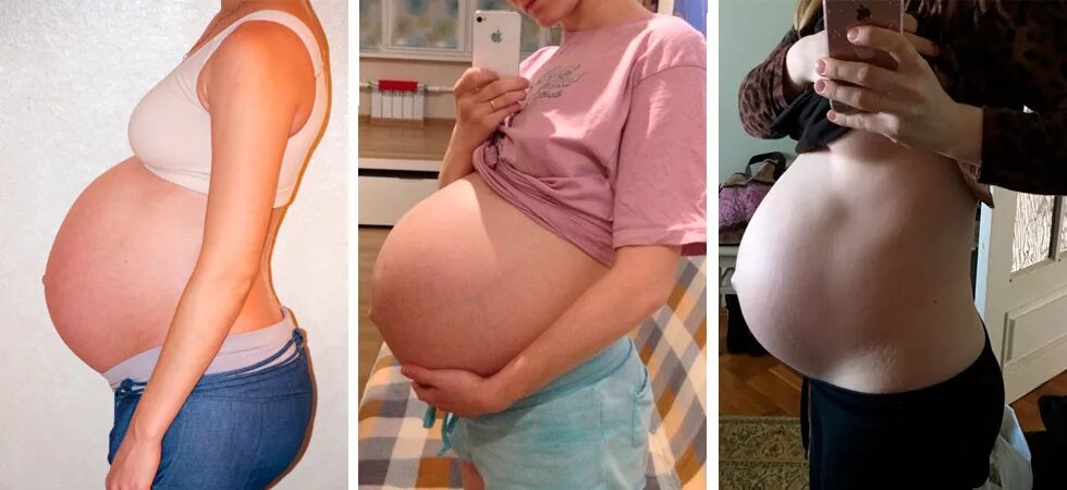Живот на 37 неделе. Большие животы при беременности. Каменеет живот на 37 неделе