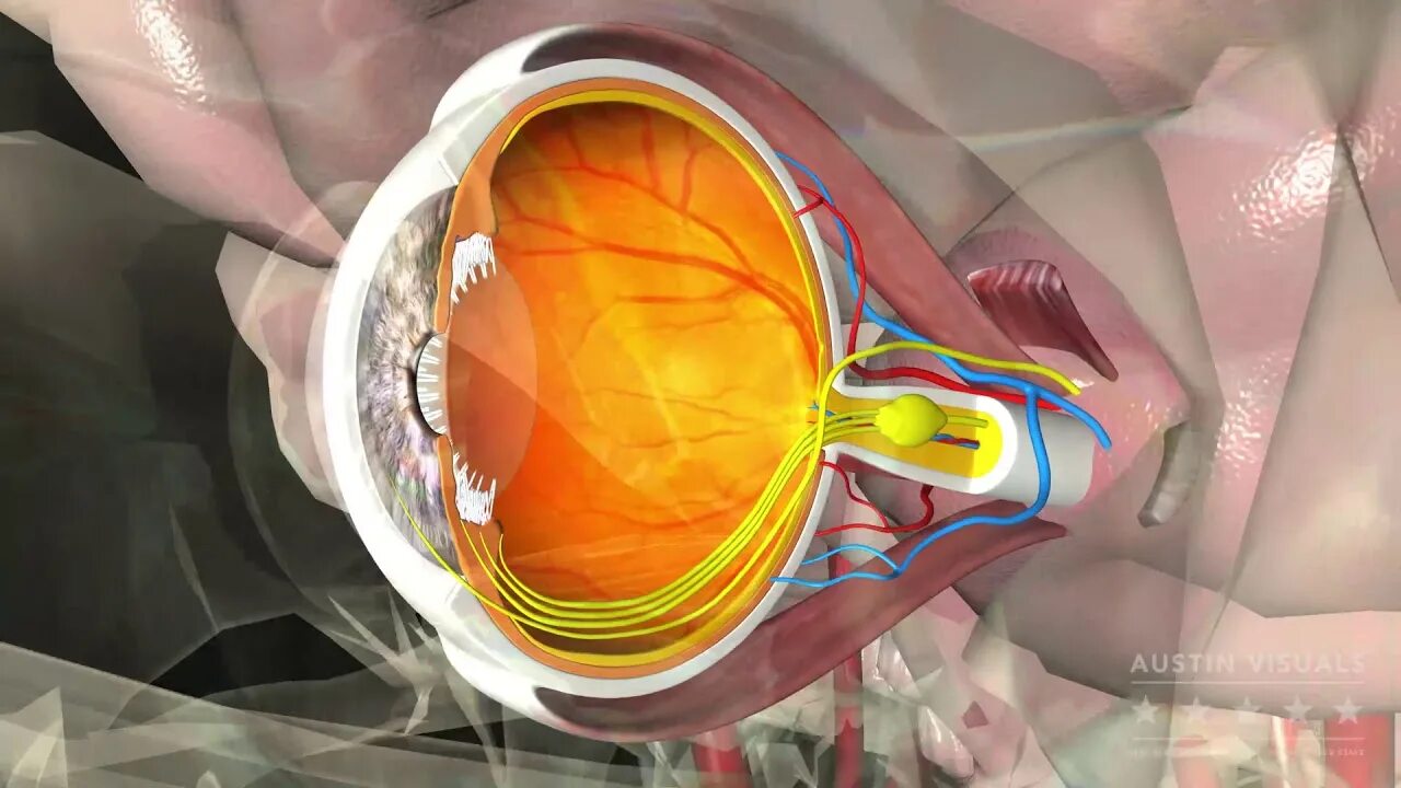 Когда восстанавливается зрение после замены хрусталика. Анатомия хрусталика 3d. Субтеноновое пространство глаза. Хрусталик и стекловидное тело.