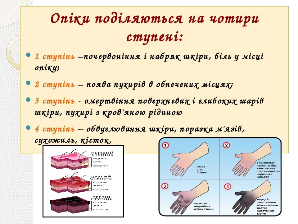 Помощь при разных степенях ожогов. Термический ожог 1 и 2 степени первая помощь. при ожогах первой степени. ожог 1 степени первая помощь.
