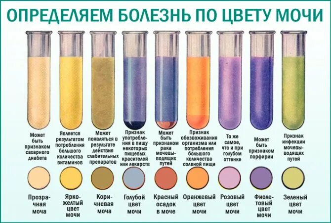 Почему Моча Во Время Секса