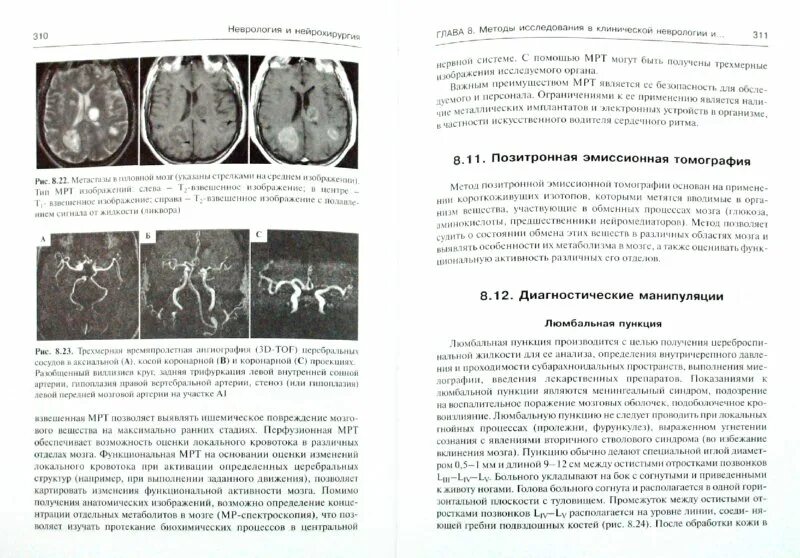 Неврология и нейрохирургия Гусев Коновалов. Неврология учебник Гусев Коновалов. Монографии по неврологии.
