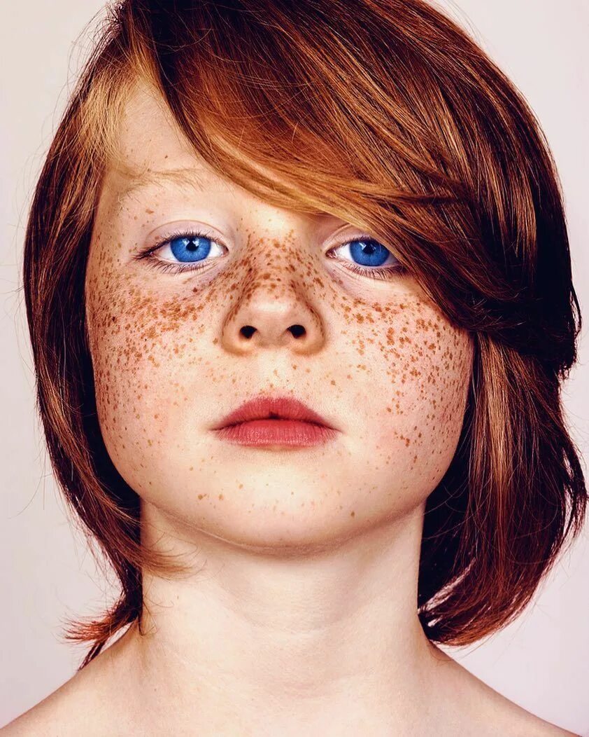 Freckles перевод. Веснушки на лице. Лицо с конопушками.