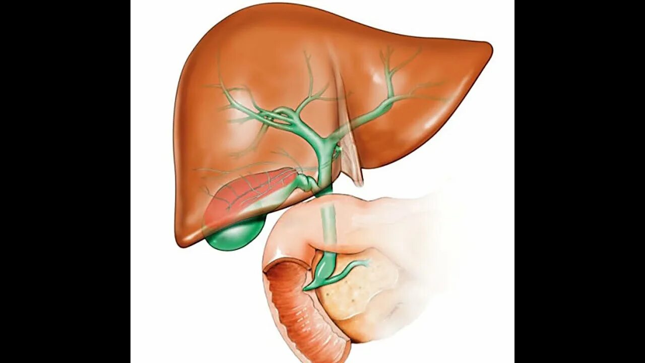 Боль печень и желчный пузырь. Холецистит желчного пузыря. Печеночный холецистит. Холецистит и дискинезия желчевыводящих путей. Хронический холецистит пузырь.