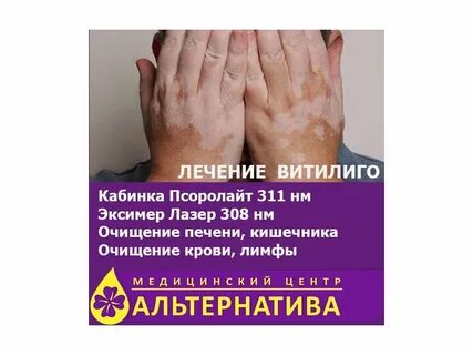 Витилиго лечение препараты
