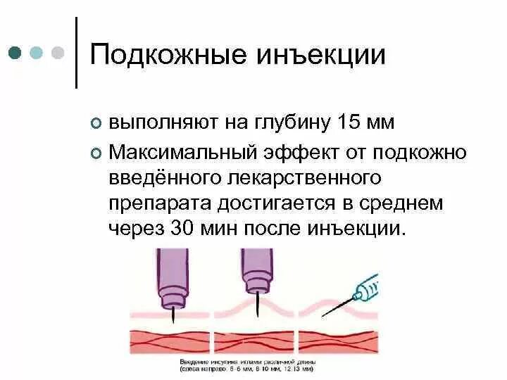 Подкожно алгоритм Введение. Подкожная инъекция алгоритм. Подкожная инъекция схема. Манипуляция подкожная инъекция алгоритм. Подкожные инъекции техника выполнения