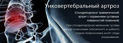 Артроз шейного отдела позвоночника лечение