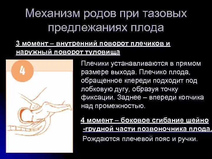 Тазовое предлежание тесты нмо. Тазовое предлежание механизм родов. механизм родов при тазовом. механизм родов при тазовом предлежании. роды при тазовом предлежании.