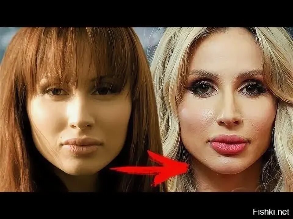 Лобода фото до и после операции Никогда не делала пластику". Пользователи сети напомнили Светлане Лободе, как он