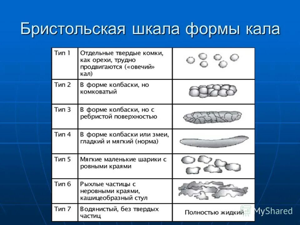 Классификация кала