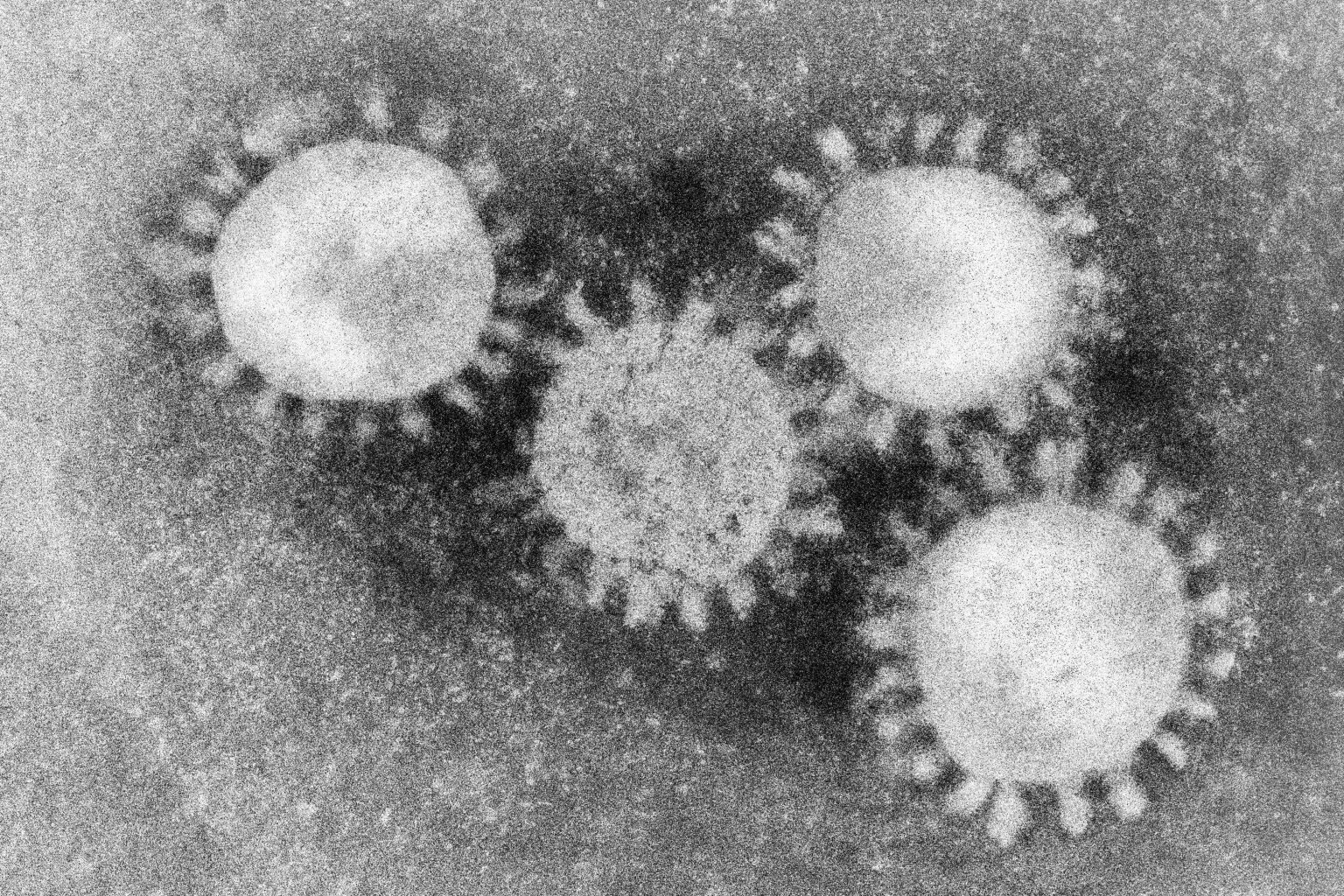 Коронавирус SARS cov 2 под микроскопом. Вирус ковид 19 под микроскопом. Вирус коронавирус микроскоп. Коронавирус под микроскопом. Ковид 2 вирус